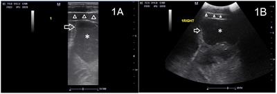 Comparison of transrectal and transabdominal transducers for use in fast localized abdominal sonography of horses presenting with colic